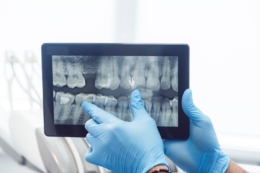 Dental Radiography